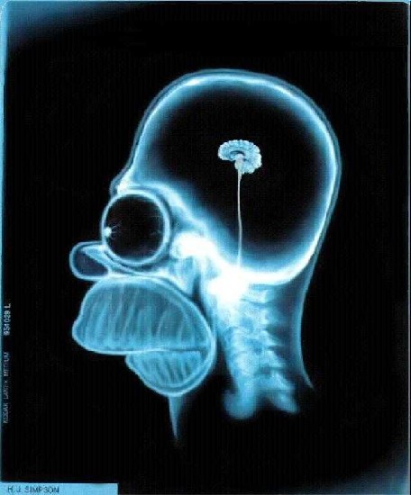 Homer's Brain